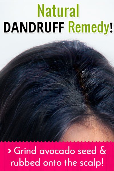 Avocado Oil Treats Dandruff