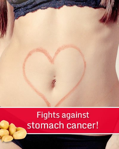 Peanuts Fighting Against Stomach Cancer