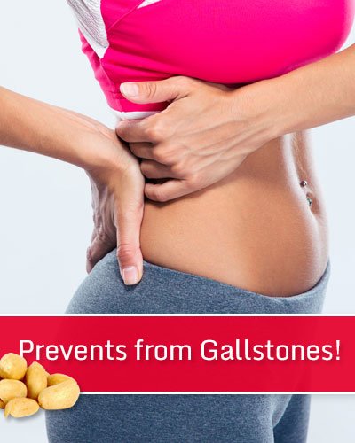 Prevents From Gallstones