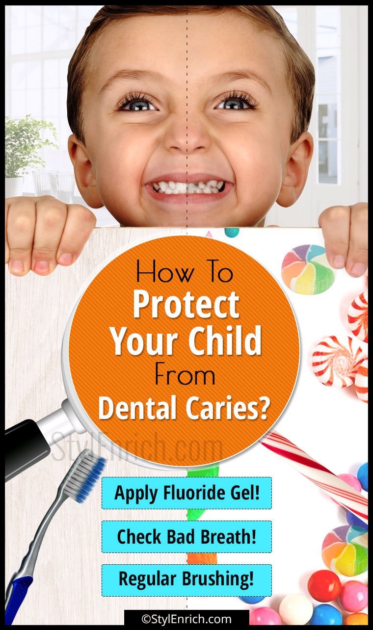 Dental Caries In Children