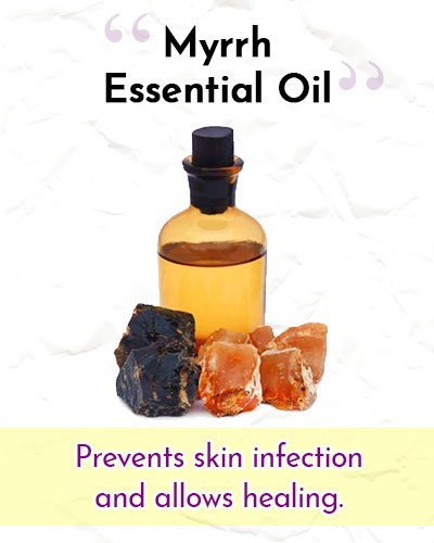 Myrrh Essential Oil For Wrinkles