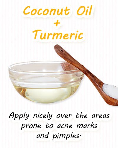 Turmeric and Coconut Oil Face Masks