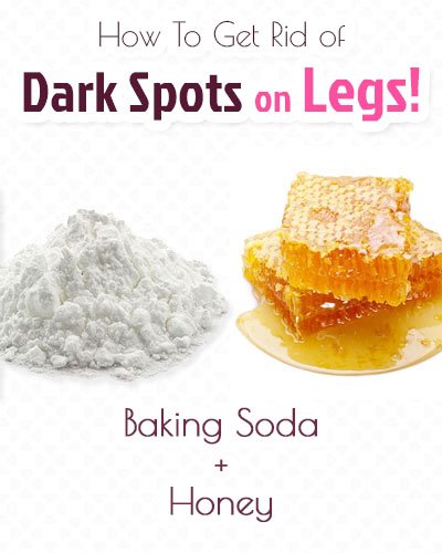 Baking Soda, Honey For Dark Spots