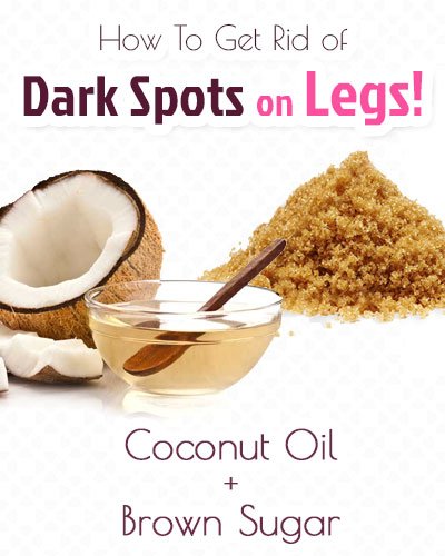 Brown Sugar and Coconut Oil for Dark Spots