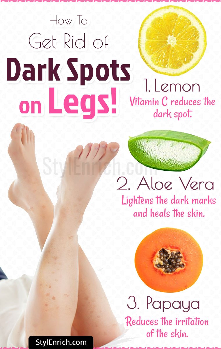 How To Get Rid Of Dark Spots On Legs With Easy Natural Organic Recipes 