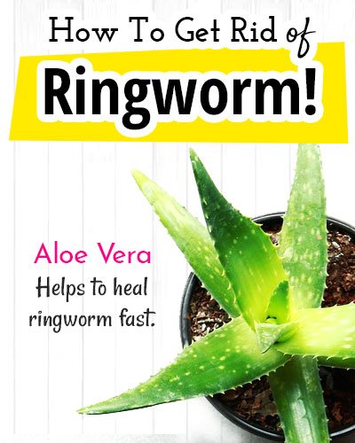 Aloevera for Ringworm