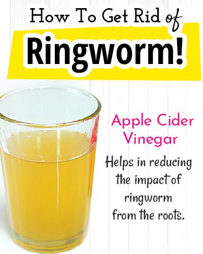 Apple Cider Vinegar for Ringworm