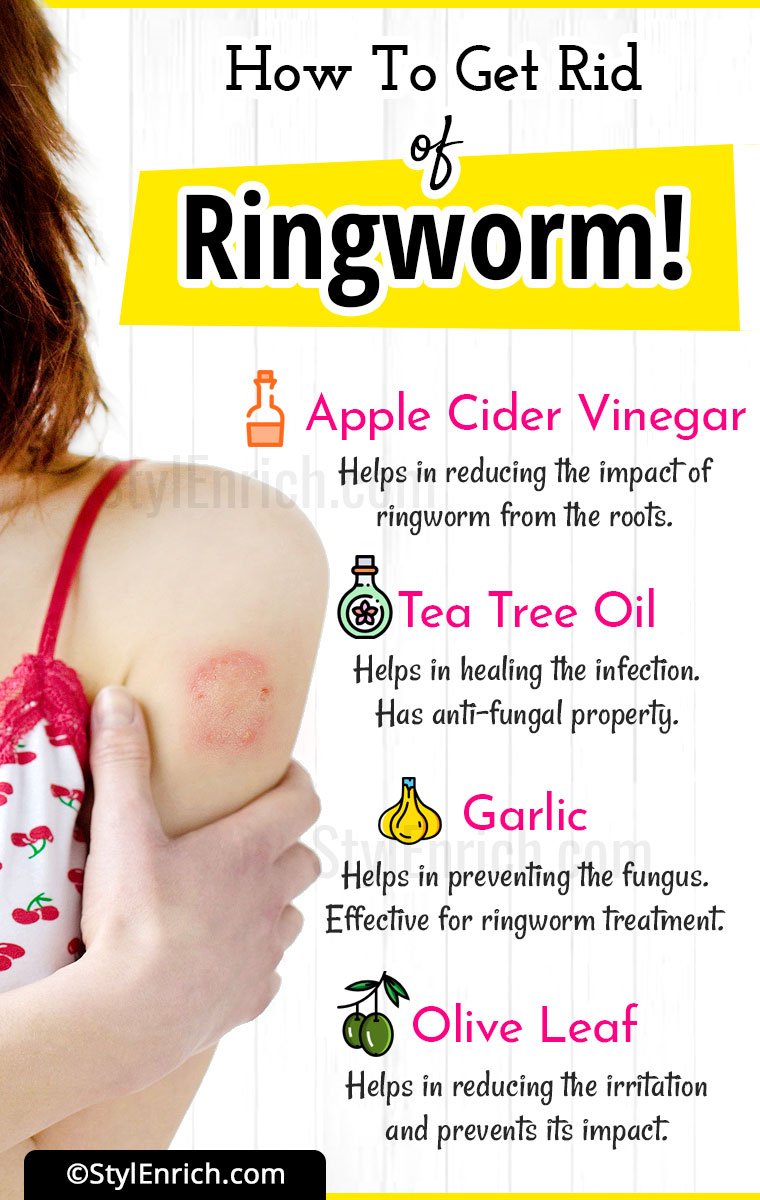 How To Get Rid Of Ringworm Home Remedies For Ringworm