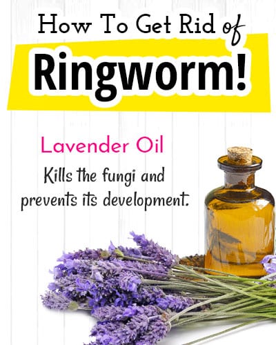 Lavender Oil for Ringworm