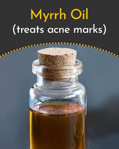 Myrrh Essential Oil for Scars