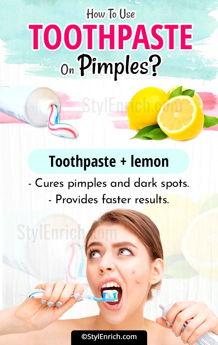 Toothpaste On Pimples And Acne Let S Learn How To Use