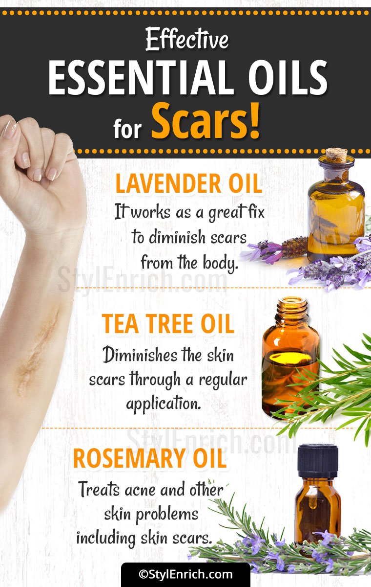 Very Effective Essential Oils for Scars!