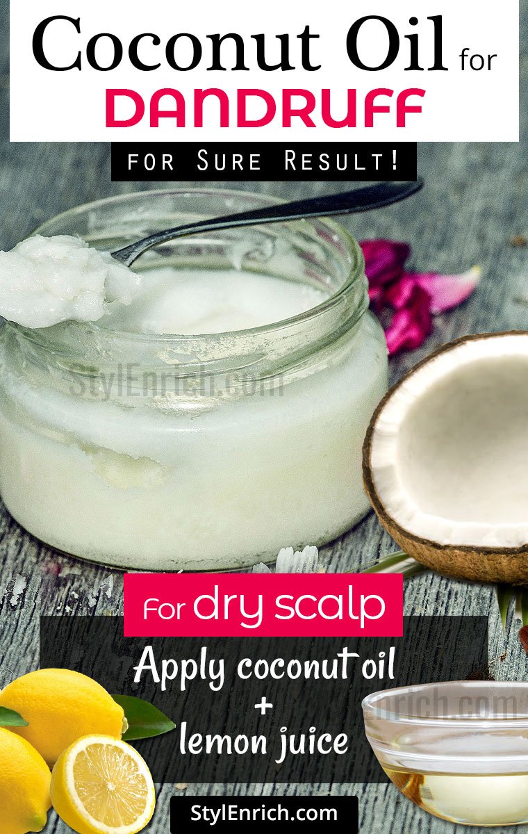 Coconut Oil for Dandruff