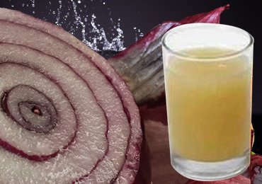 Benefits of Onion Juice for Hair