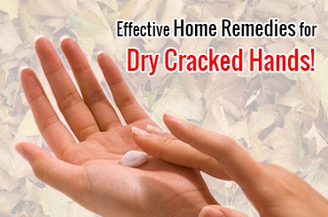Home Remedies for Dry Cracked Hands
