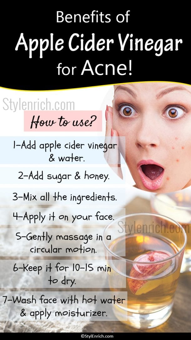 Apple Cider Vinegar For Acne And An Effective Way To Use!