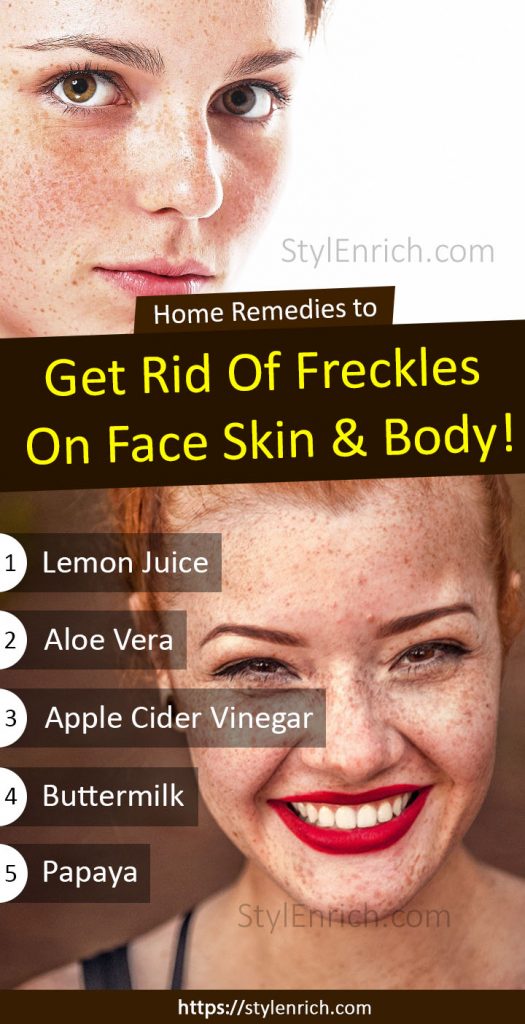 How To Get Rid Of Freckles On Face And Skin Using Organic Remedies 6629