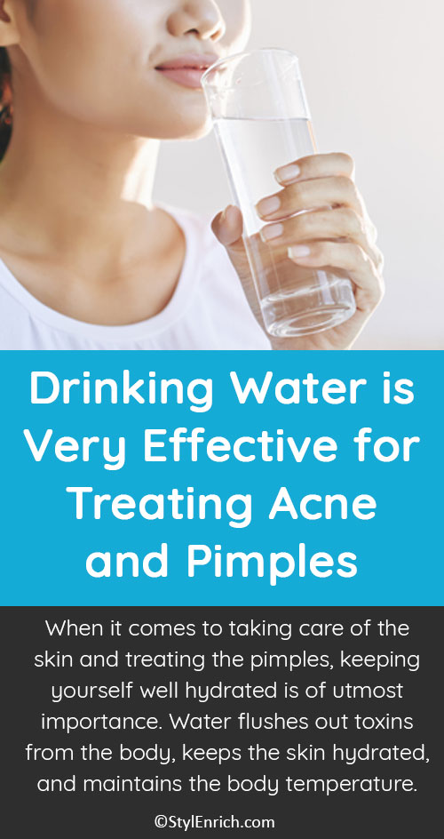 Drink Enough Water Everyday to Treat Acne and Pimples