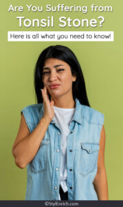 Tonsil Stones : All You Need to Know from Symptoms to Treatment!